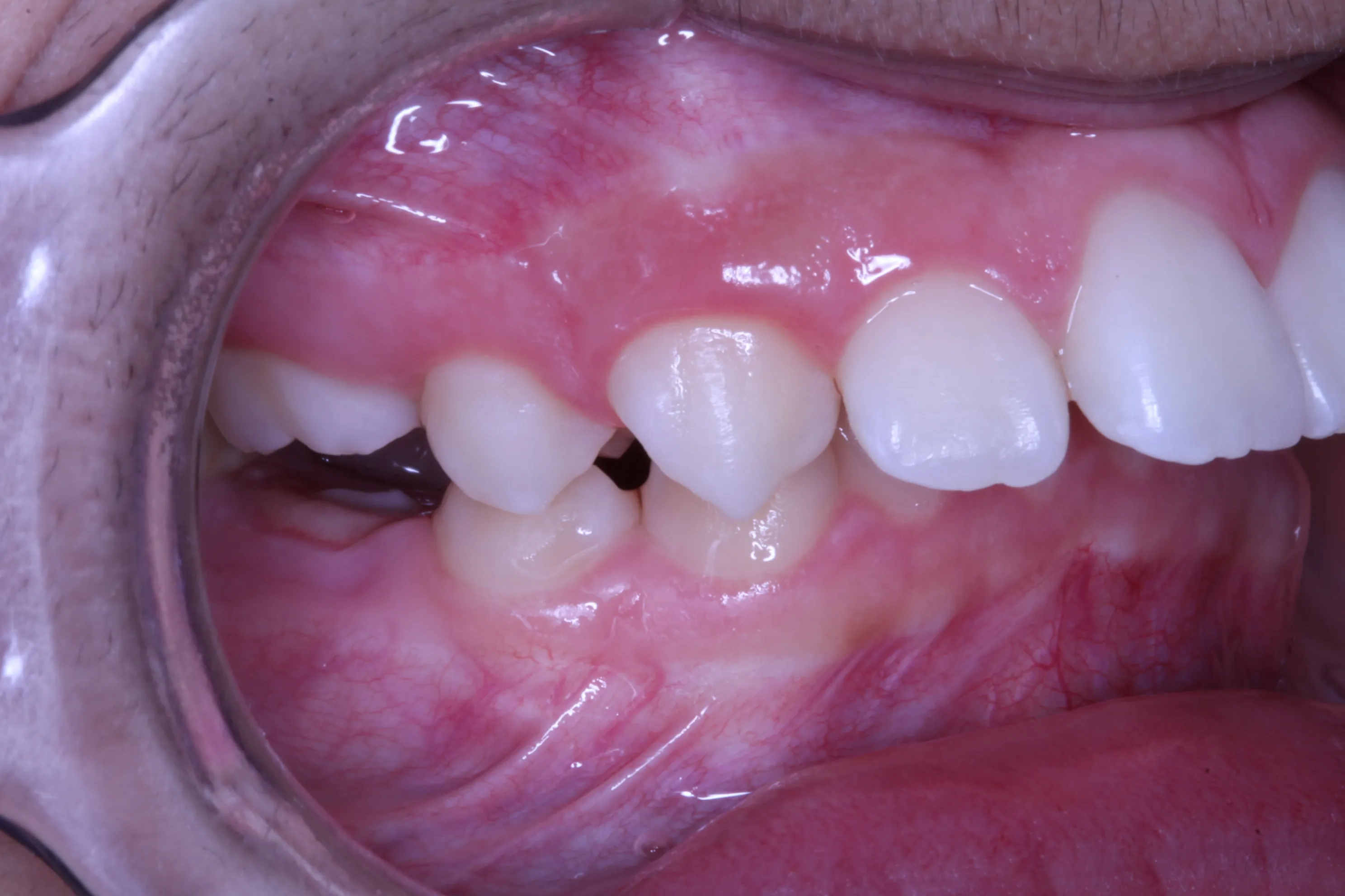 smile-gallery gallery